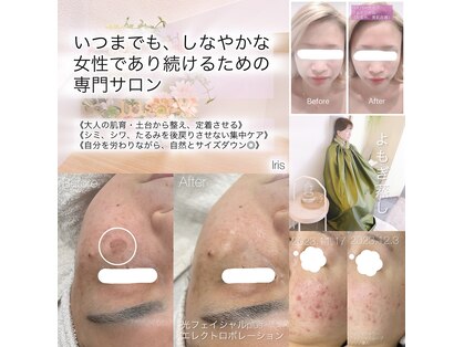 イリス(Iris)の写真