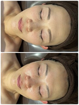 ラナ(Lana)/【ララピール】【セルマン】