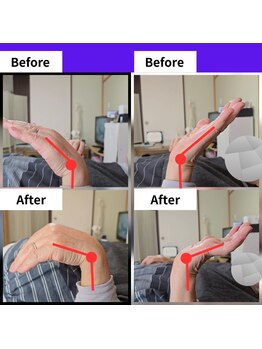Re:ひざケア/痛めた手首が背骨で改善！！