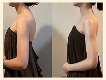 【肩こり/リンパマッサージ/小顔/ヘッドスパ】肩甲骨はがし肩こり整体RUFFREE高尾院/猫背/巻き肩姿勢改善に姿勢矯正