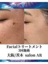 メンズサロンアール(AR)/プロセルセラピーズ