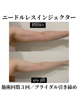 サラ/ブライダル