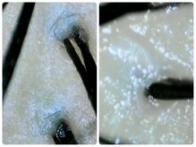 ゼン(ZeN)/マイクロスコープ