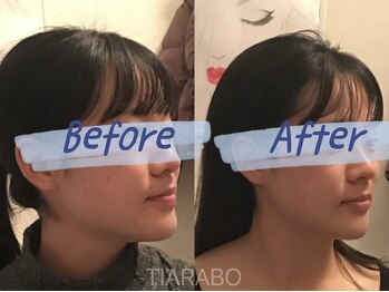 ティアラボ(TIARABO)/