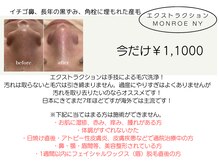 KMB 中崎町店/毛穴洗浄/モンロー式