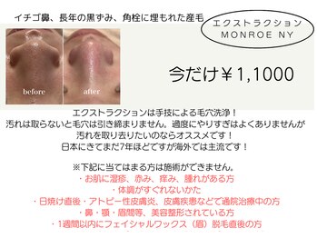 KMB 中崎町店/毛穴洗浄/モンロー式