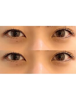 ユーロ(EURO)/ラッシュリフト