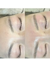 十美/【美眉♪】before　after