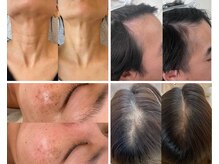 アオラ(Aola)の雰囲気（プロセルセラピーズ導入店。頭皮・お肌のお悩み解決出来ます！）