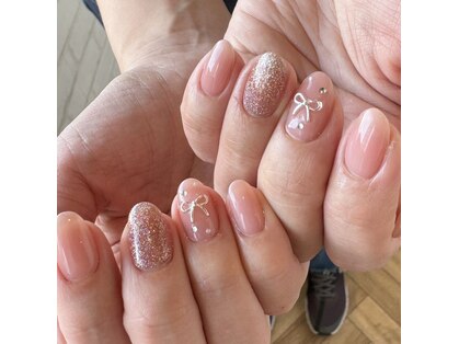 パラジェル/フィルインの写真