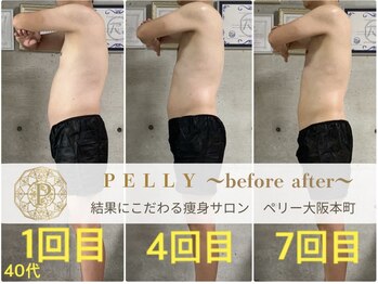 ペリー(PELLY)/男性40代　before after