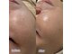 アキネ(Akine.)の写真