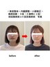 【エラ張り・お顔の左右差◎キレイなラインを】 姿勢改善×小顔・内臓調整