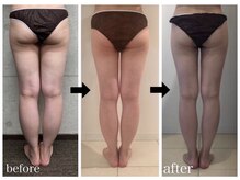 美人バスト 新宿店/☆姉妹店ダイエット症例写真☆