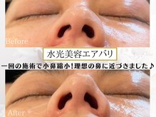 プリンセスフォー/ビフォーアフター☆