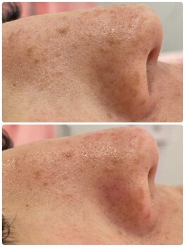 シャルム(Charme)/スモアメソッド