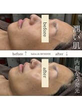 サロンドリシェス(Salon de RICHESSE)/水分量が足りないお肌に栄養を！