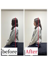 整体院ストック(Stock)/猫背・巻き肩before After #整体
