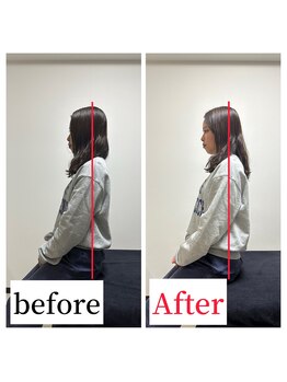 整体院ストック(Stock)/猫背・巻き肩before After #整体