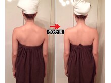 美座ノ女 梅田 淀屋橋本店/施術前後(背面)