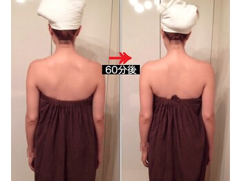 美座ノ女 梅田 淀屋橋本店/施術前後(背面)