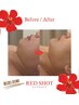 【脂肪分解+エイジングケア】RED SHOTレッドショット【レモンボトル進化版】