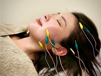 グリーン 京都店(green)の写真/【シンプル美容鍼60分¥3650】微弱電流&美容鍼で内側からたるみケア！お肌の調子も良くなると口コミでも話題