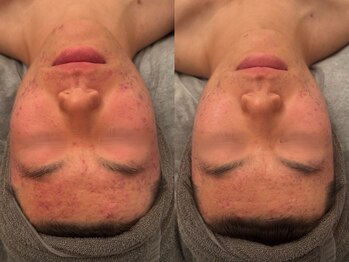 ポーデベロア(Peau des velours)/陶肌トリートメント/ホームケア