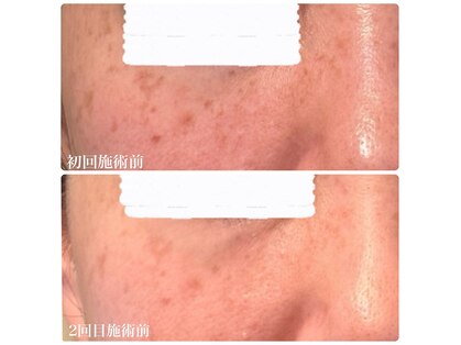 フルオール(FRUOR)の写真