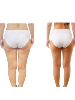ルッカ(RUKKA)/食べ痩せ×セルライトケア