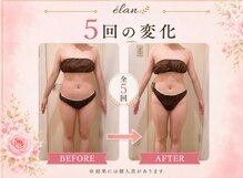 ヨサパーク エラン 藤が丘店(YOSA PARK elan)