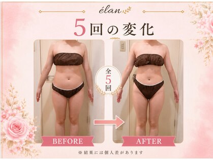 ヨサパーク エラン 藤が丘店(YOSA PARK elan)の写真