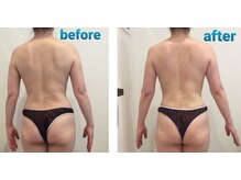 ミエル(Miel)/Before After