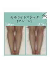 ザラハビューティー(ZARAHA Beauty)/C'elluliteMagic