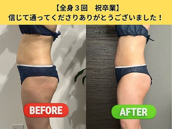 ヘッテ(Hette)/全身変わると別人級！