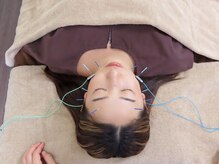 ゆしんアネックスの雰囲気（たった30分で効果実感！綺麗なお顔を写真に残したい方！）