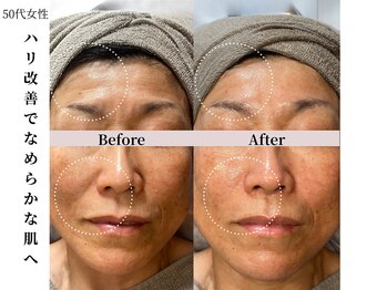 ヴィタベラ(Vita Bella)/ラミネーションピール