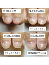 マニエネイル(mani e nail)/深爪矯正サロンができること