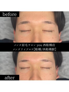 ユー 西船橋店(you)/ビフォーアフター写真