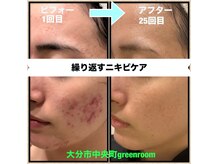 グリーンルーム(green room)