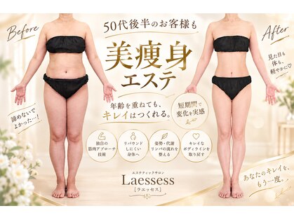 ラエッセス(A Laessess)の写真