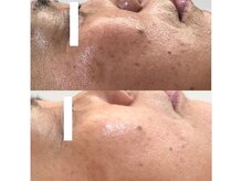 ティアス(t-us)/【ハーブ】エイジングケア