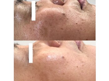 ティアス(t-us)/【ハーブ】エイジングケア