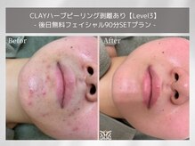 スリジエ ボーテ(cerisierBEAUTE)