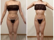 プリマ(prima)の雰囲気（本格痩身！ダイエットメニュー！最後のダイエットを☆）