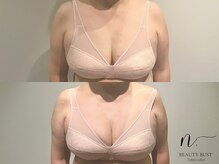 エヌドット 日本橋(N.)/下垂にお悩みのお客様