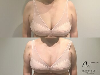 エヌドット 日本橋(N.)/下垂にお悩みのお客様