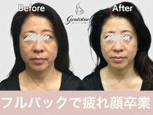 ゲントツ 参宮橋店(gentotsu)の雰囲気（手の疲れからアプローチで圧倒的小顔　/小顔矯正/姿勢矯正/小顔）