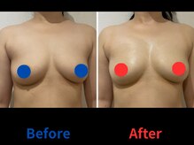 ポインセチア(Poinsettia)/ダイナミックバスト4DX/並び比較