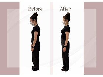 心斎橋長堀フェムテック整骨院/姿勢矯正　全身整体　ピラティス